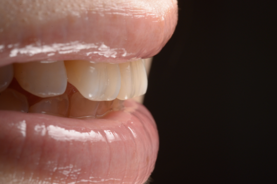 審美歯科治療 - 医療法人しみず歯科 グランデンタルクリニック（岡山県